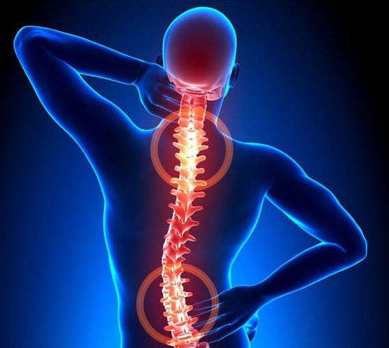Схематическое изображение боли в спине