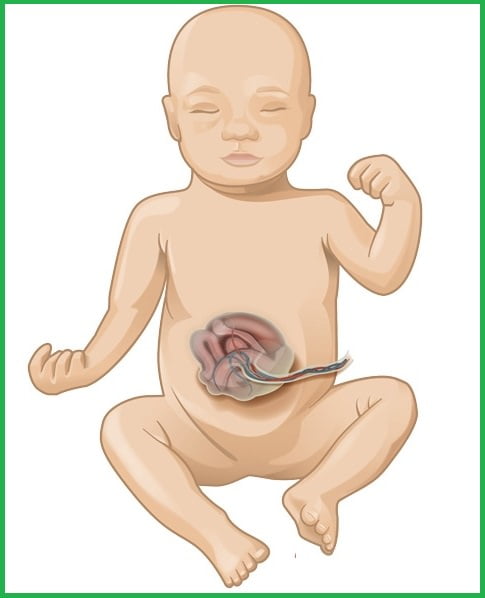 Рисунок младенца с паталогией
