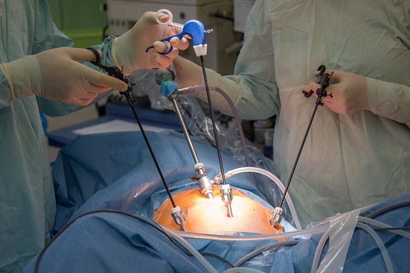 Два врача проводят операцию по удалению грыжи.